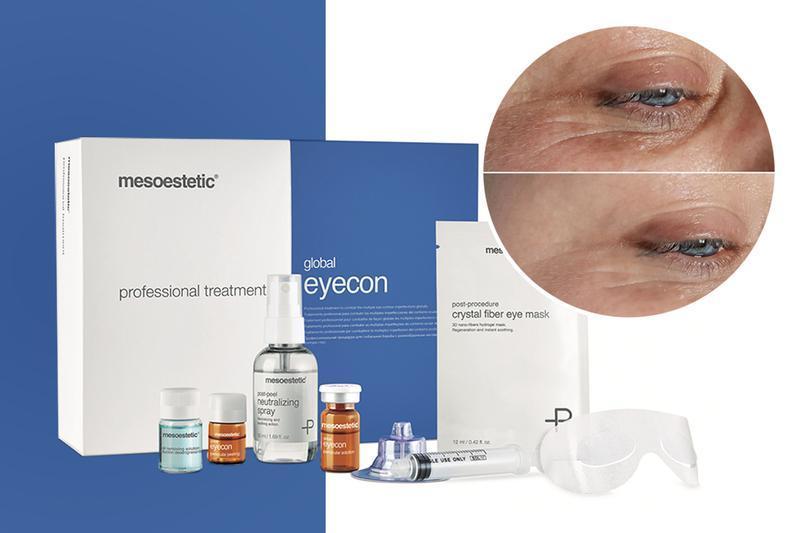 Global Eyecone Treatment
